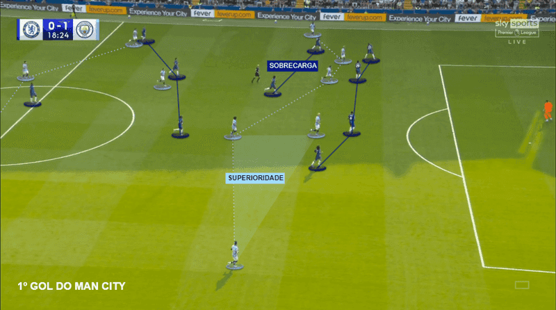 Infiltração Lateral sem ruptura